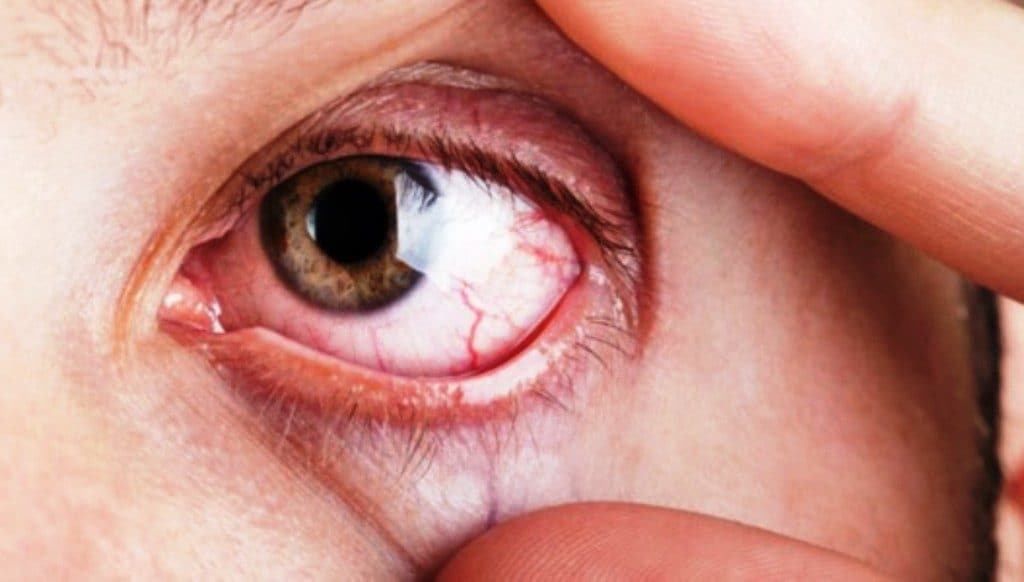 que-problemas-pueden-tratar-los-oculistas-en-merida3
