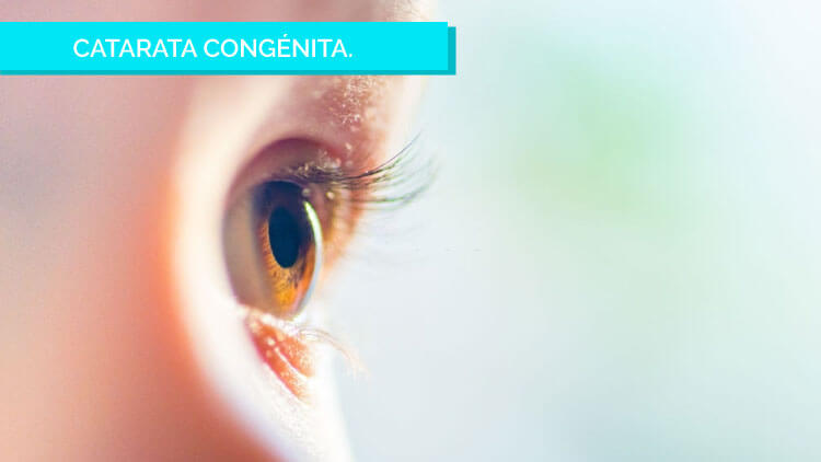 ¿Qué puedes esperar de la cirugía de cataratas?